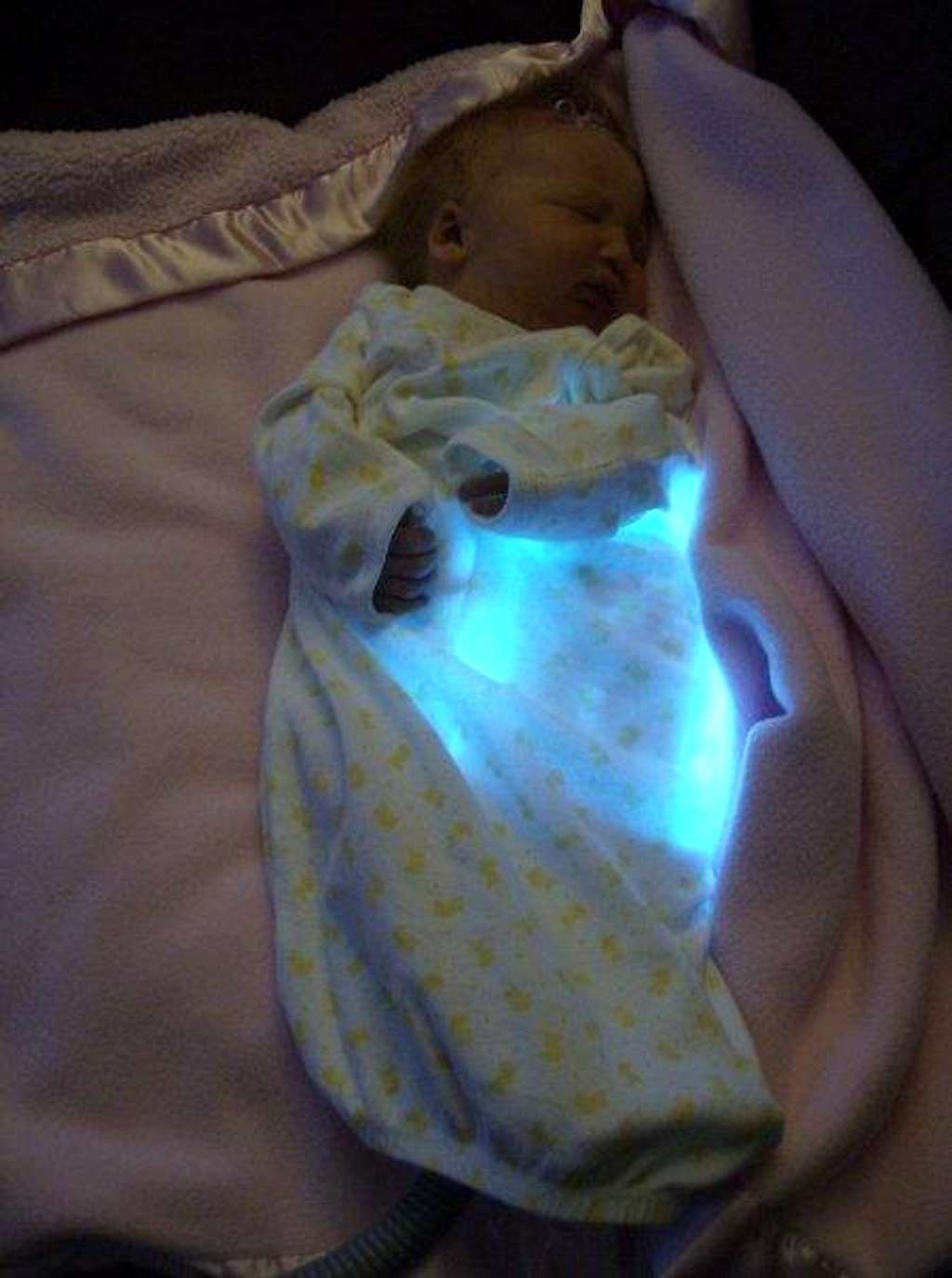 Jaundice, or a way to stay connected to the mothership?