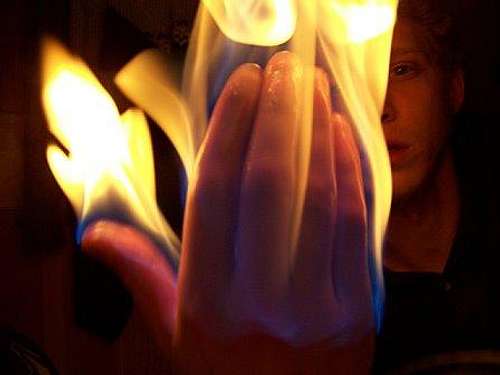 Burning hand...